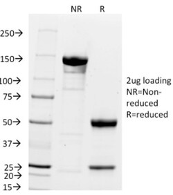 p21/CIP1/CDKN1A Antibody (DCS-60.2), Novus Biologicals 0.2mg; Unlabeled:Antibodies,